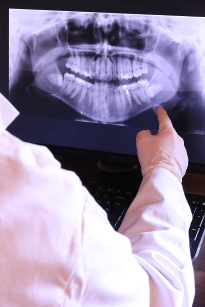 Best Emergency Dentist for Lost Fillings or Crowns in Beverly, MA