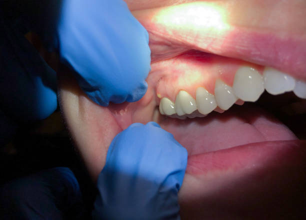 Trusted MA Emergency Dentist Experts